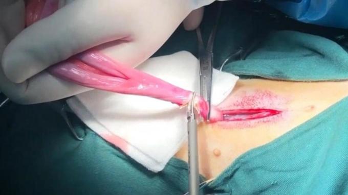 آخرین مورد شرکت استفاده از اسکالپل التراسونیک حیوانات خانگی در عقیم سازی گربه و جراحی عقیم | Surgsci  0