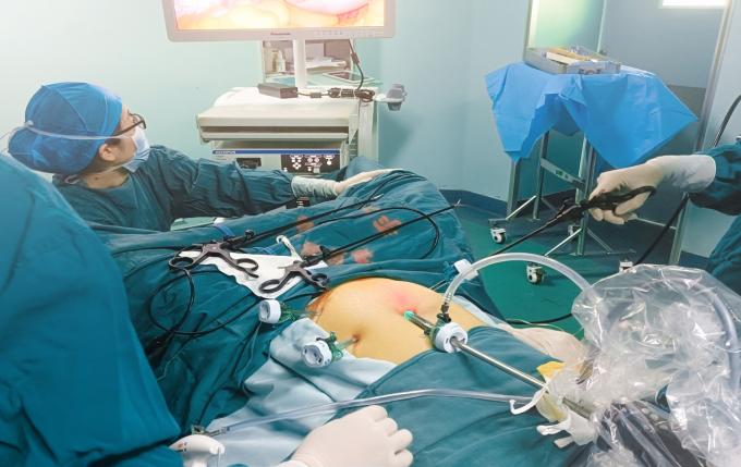 تروکار و کانول اپتیکال یکبار مصرف استریل قابل جدا شدن برای جراحی لاپاراسکوپی 6