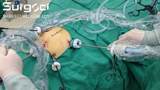 آخرین اخبار شرکت توزیع کننده ما در کشور خود شوید | SurgSci  0